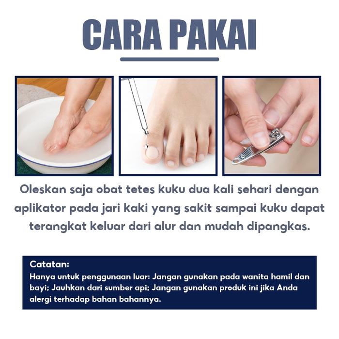 Obat Jamur Kuku Serum Kuku Obat Cantengan Jempol Kaki Kuku Perawatan Kuku Obat Kuku Cantengan Jempol