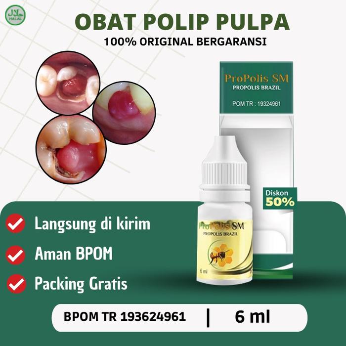 PROPOLIS SM - OBAT POLIP GIGI, OBAT GUSI BENGKAK, OBAT GUSI BERDARAH, OBAT BENJOLAN GIGI, OBAT GIGI