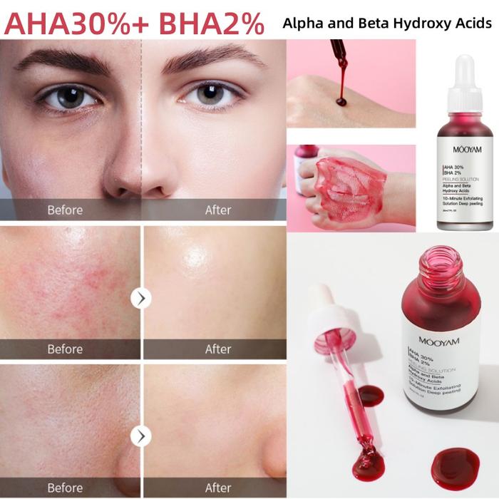 AHA30% BHA2% Glycolic Acid Peeling Solutions  Facial