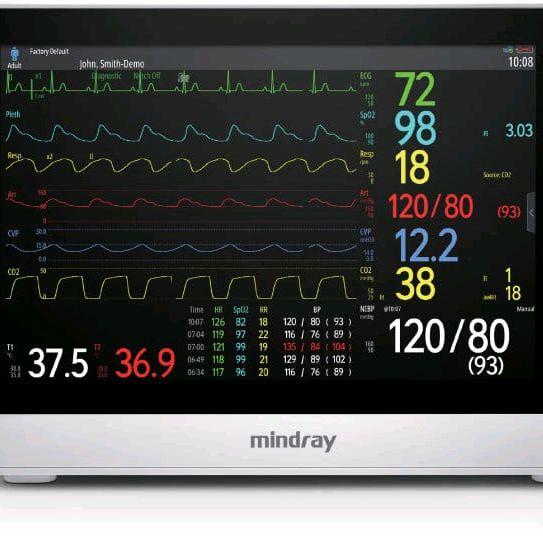 PATIENT MONITOR MINDRAY UMEC 100 / MINDRAY UMEC 100 / PATIENT MONITOR
