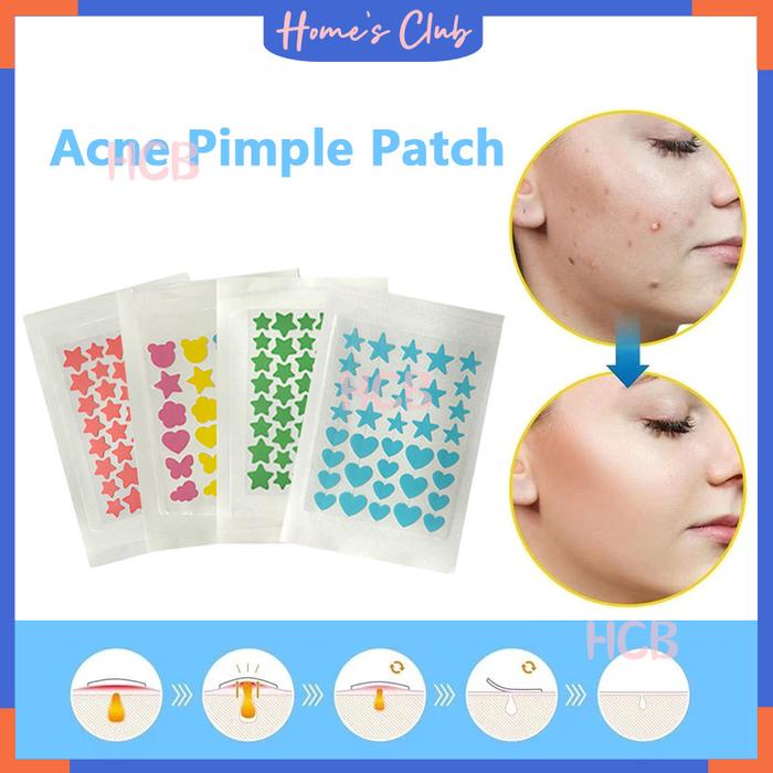 Acne Pimple Patch Colorful Hydrocolloid Acne Pimple Patch 36 Pcs