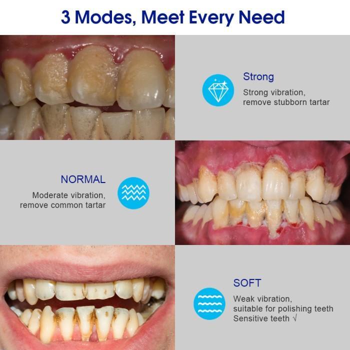 TERBARU!!! Alat Pembersih Karang Gigi YOUPIN Dental Calculus Remover