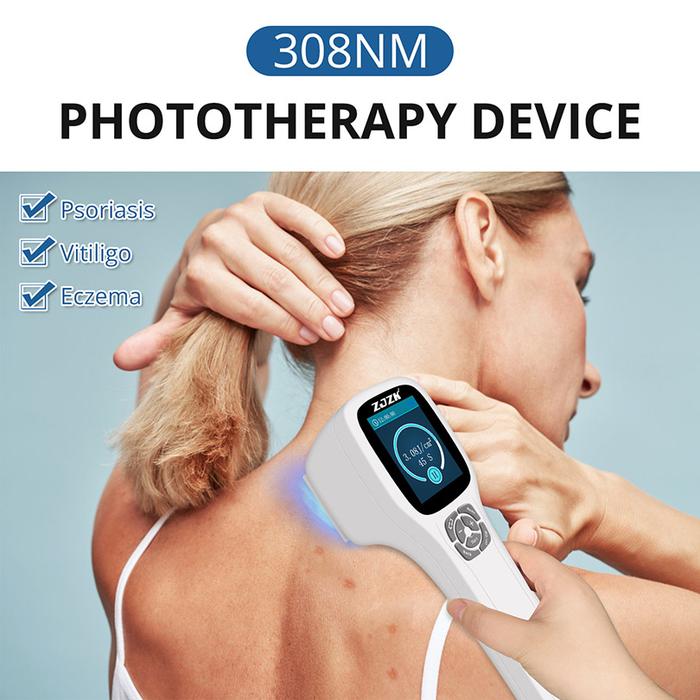 Medical Equipment Portable 450mW Uvb Light Therapy Psoriasis Lamp 308nm Narrow Band Phototherapy For