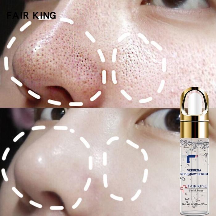FAIR KING Pore Minimizing and Smoothing Face Essence Shrink Pores