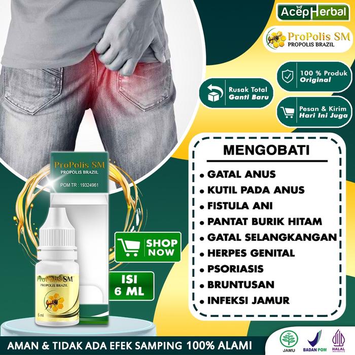 OBAT GATAL ANUS DEWASA LUKA SALEP KUTIL DI ANUS FISTULA ANI PANTAT BURIK HITAM BRUNTUSAN GATEL SELAN