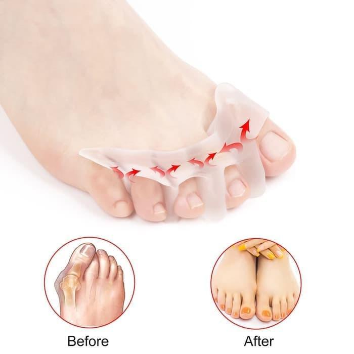 Pemisah Jari Kaki Silikon Gel Toe Separator Jari Jempol Silicon Bunion Pasti Ori
