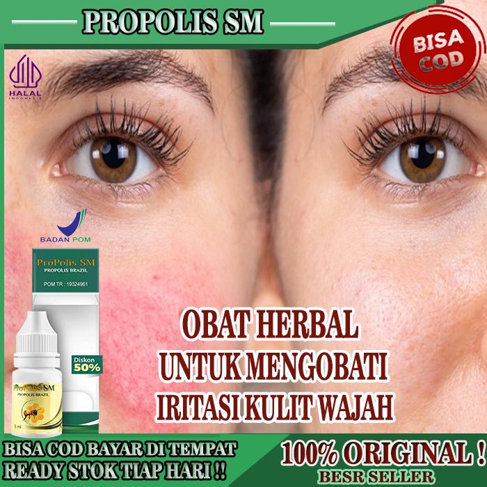 OBAT IRITASI KULIT WAJAH, OBAT JAMUR KULIT WAJAH, OBAT INFEKSI KULIT AKIBAT KOSMETIK, OBAT KAPSUL HE