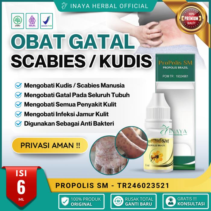OBAT SCABIES / KUDIS, SALEP BUDUG BERNANAH, OBAT GUDIK, OBAT BOROK, OBAT CENANG, OBAT GATAL BERAIR,
