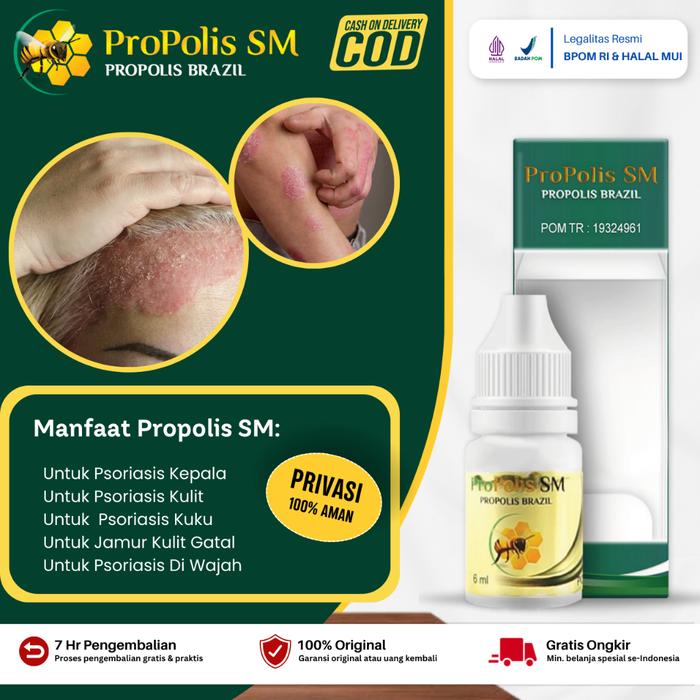 OBAT PSORIASIS KULIT KEPALA PSORIASIS KULIT PSORIASIS KEPALA PSORIASIS KUKU JAMUR KULIT GATAL PROPOL