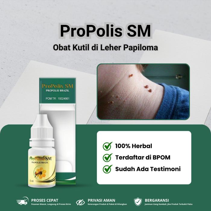 PROPOLIS SM - OBAT KUTIL DI LEHER PAPILOMA, OBAT PERONTOK KUTIL DI LEHER, OBAT PENGHILANG KUTIL