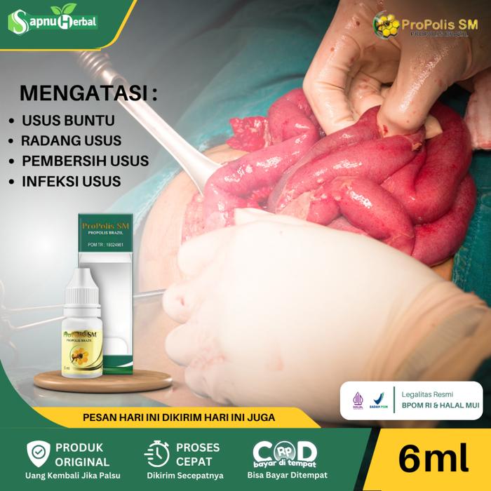 OBAT USUS BUNTU RADANG USUS KRAM USUS INFEKSI USUS PEMBERSIH USUS KOTOR USUS MELILIT USUS BUNTU PECA