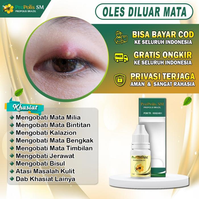 OBAT MATA BINTITAN BENGKAK MATA KALAZION TIMBILAN MILIA BENJOLAN DEKAT MATA OBAT OLES PROPOLIS SM