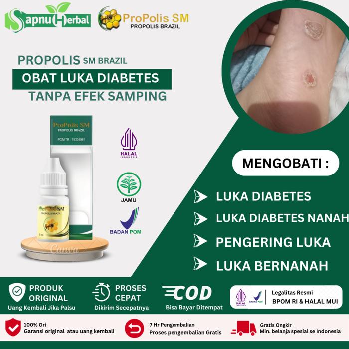 OBAT LUKA DIABETES, OBAT LUKA DIABETES BASAH AGAR CEPAT KERING, OBAT LUKA DIABETES BERNANAH, OBAT PE