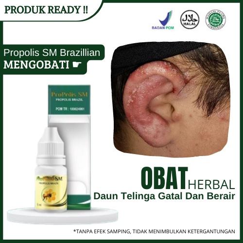 OBAT DAUN TELINGA GATAL DAN BERAIR, TELINGA KERING, INFEKSI JAMUR TELINGA, DERMATITIS/EKSIM PROPOLIS
