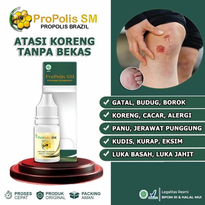 OBAT KORENG PENGHILANG BEKAS KORENG GATAL BUDUG CACAR BEKAS LUKA OBAT TETES PROPOLIS SM