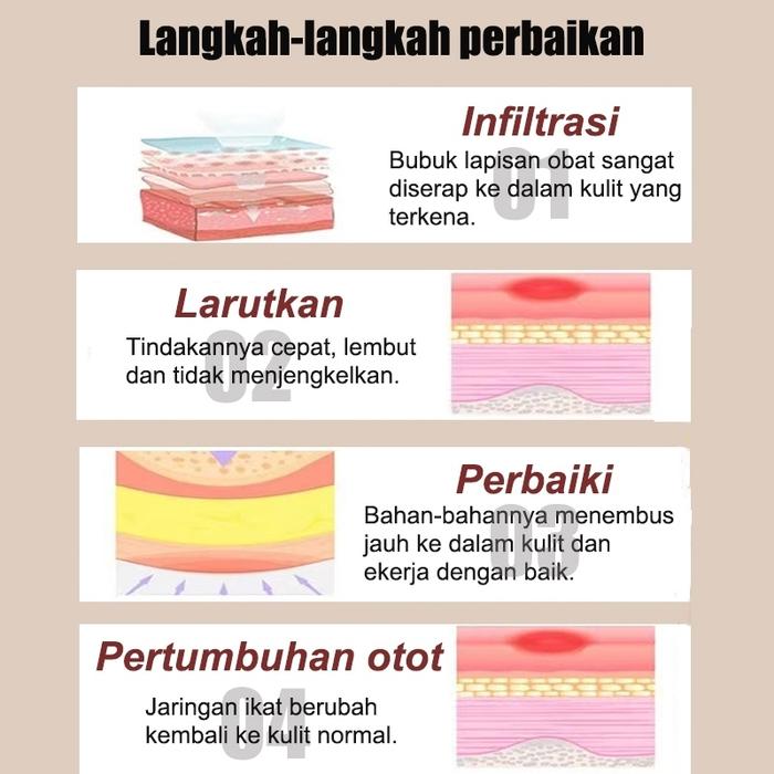 Krim Luka Baring/Penyembuhan Luka/Salep Luka Diabetes/Salep Luka Cepat Kering 30G Penyembuhan Luka K