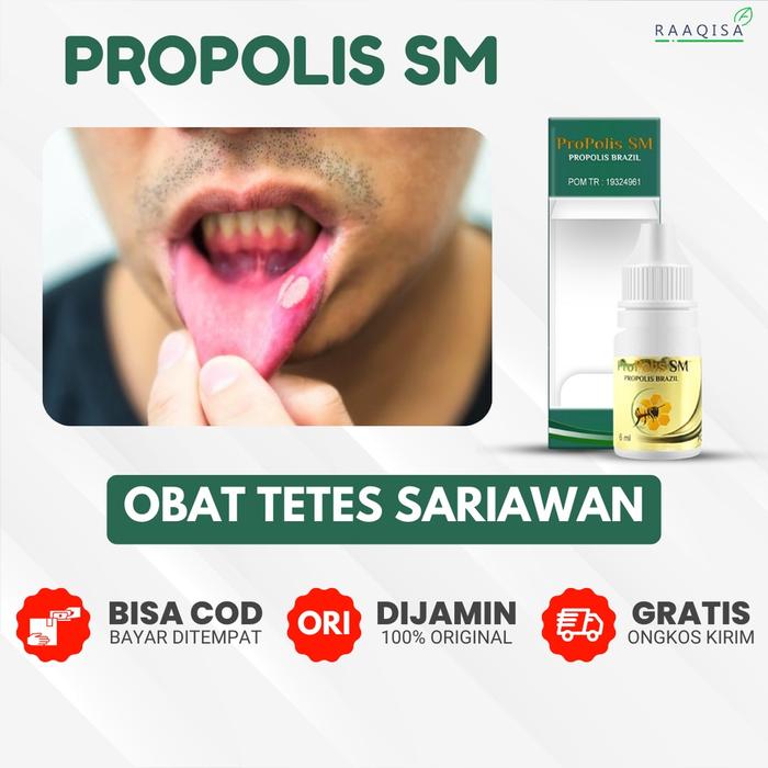OBAT SARIAWAN PARAH, RADANG SARIAWAN, SARIAWAN DI TENGGOROKAN, SARIAWAN DI LIDAH, SARIAWAN DI GUSI, 