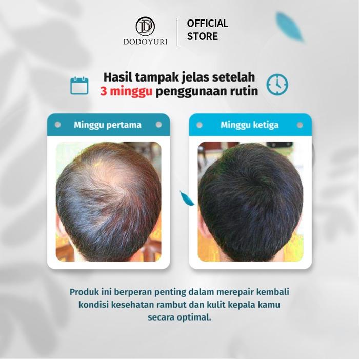 Obat wasir Obat hemoroid Semprotan wasir obat ambeien paling ampuh