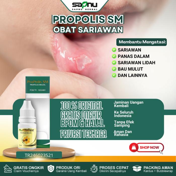 OBAT SARIAWAN, OBAT SARIAWAN MULUT, OBAT SARIAWAN DI LIDAH, OBAT SARIAWAN DI BIBIR, OBAT MENGHILANGK