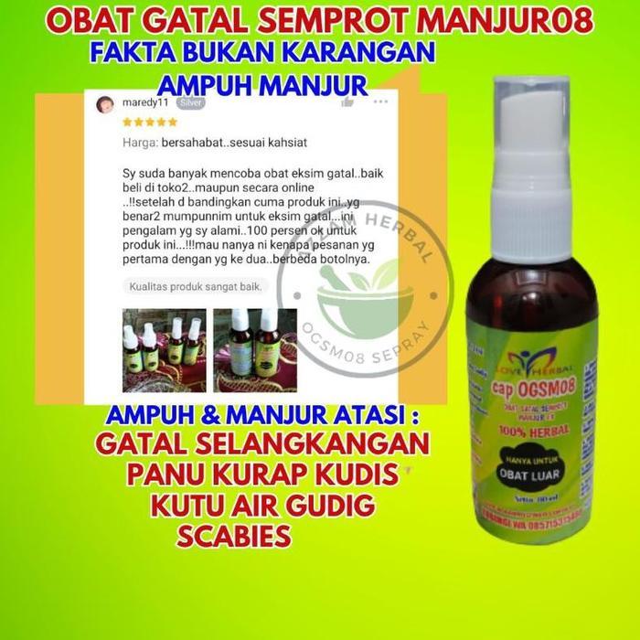 Obat gatal Jamur kulit panu kurap kudis paling ampuh