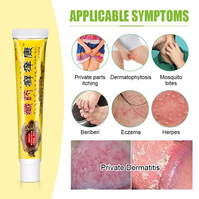 2pcs Psoriasis Cream Eczema Dermatitis Scalp Hand Tinea Pedis Tinea Inhibit Fungus Anti-itch Chinese
