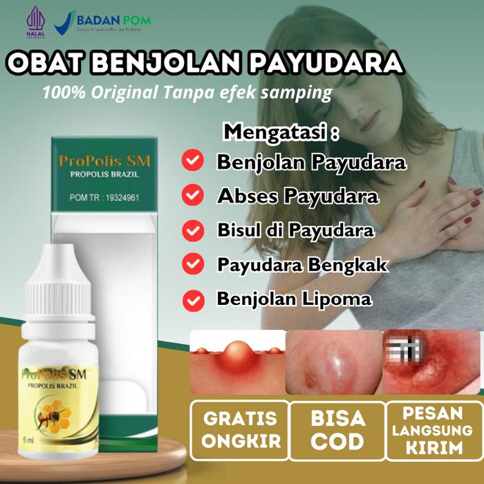 OBAT BENJOLAN DI PAYUDARA, PENGHANCUR TUMOR DI PAYUDARA, OBAT KISTA PAYUDARA, PEREDA NYERI PAYUDARA,