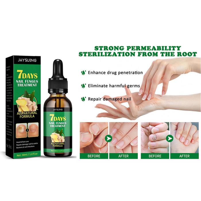 Abian-Organic Obat Jamur Kuku Obat Kuku Jamur Dan Rusak Perawatan Kuku Berjamur Antibakteri Perawata