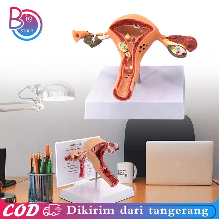 New Uterus Ovary Anatomical Model Anatomy Alat Peraga Anatomi Model Patologis Uterus Ovarium Manekin