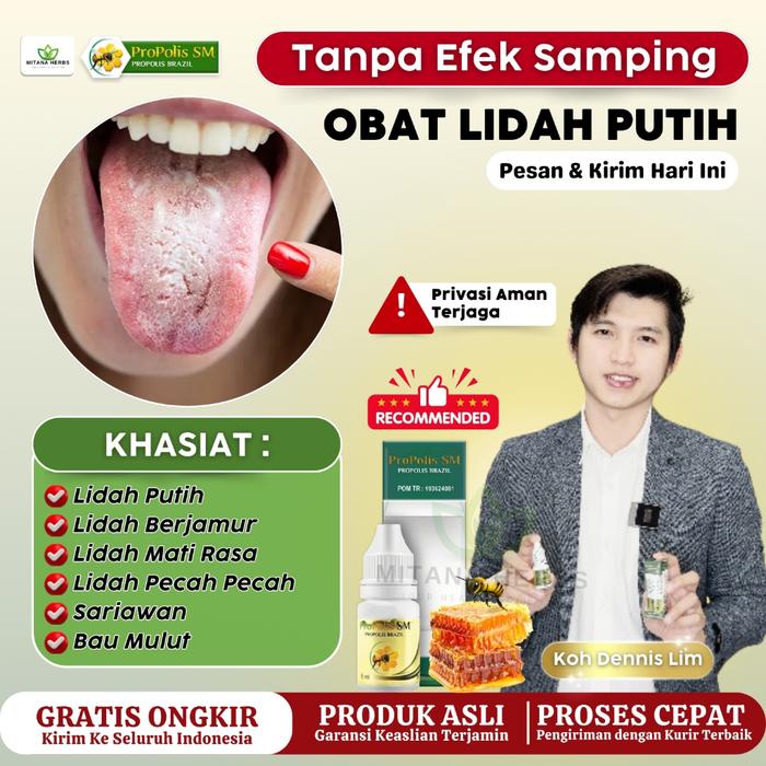 OBAT LIDAH PUTIH, OBAT LIDAH PUTIH BERJAMUR, OBAT LIDAH PECAH PECAH, LIDAH MATI RASA ANAK & DEWASA