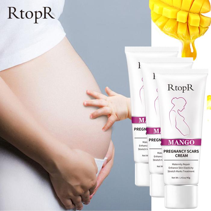 RtopR 3PCS Mango Remove Pregnancy Scars  Stretch Marks