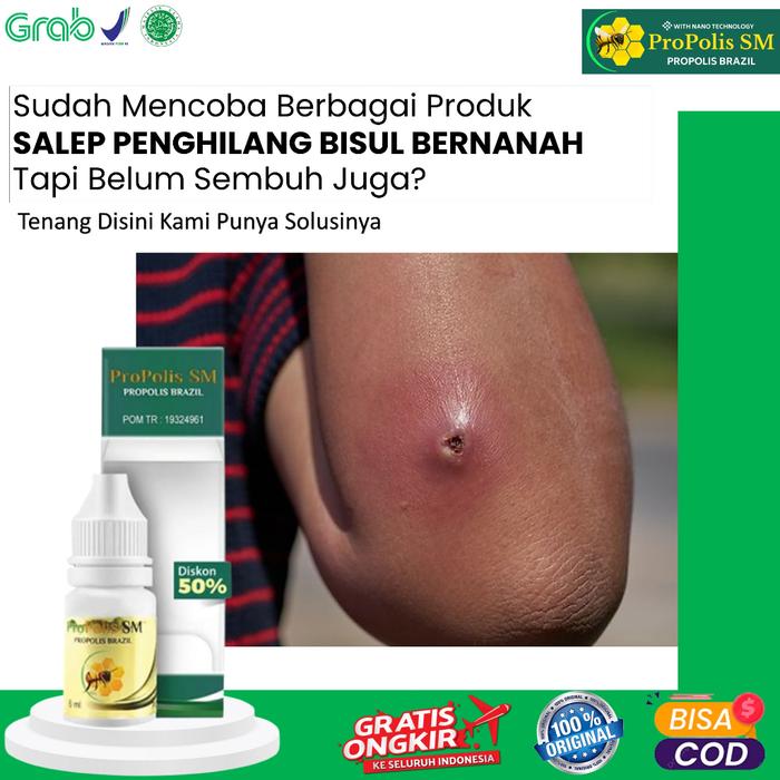OBAT BISUL PENGHILANG BENJOLAN BISUL BERNANAH WALATRA PROPOLIS SM JAMIN ORI - RISMAN HERBAL