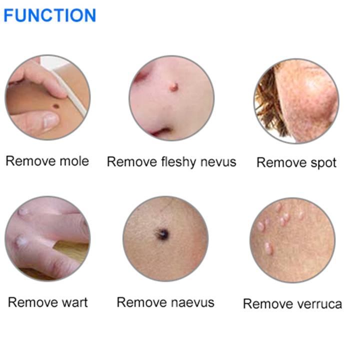 Maglev Plasma Pen Eyelid Lifting Laser Fibroblast Spot Removal