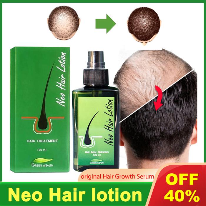 neo hair lotion hair grow Serum hair care oil essential hair loss