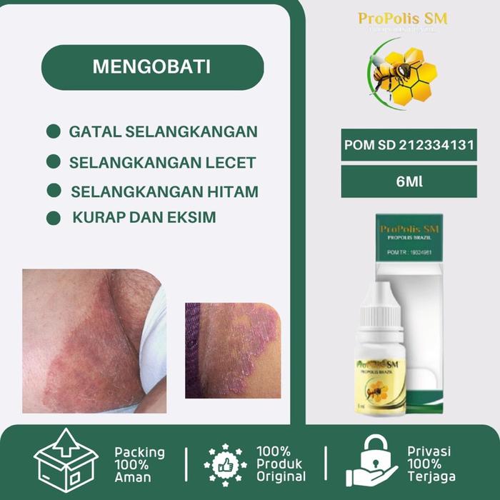 MAFAZA HERBS - OBAT GATAL SELANGKANGAN - TINEA CRURIS - INFEKSI JAMUR SELANGKANGAN - SELANGKANGAN HI