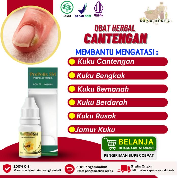 KAKA HERBAL - OBAT CANTENGAN JEMPOL KUKU KAKI DAN TANGAN, KUKU BENGKAK BERNANAH NYERI BAU BUSUK, OBA