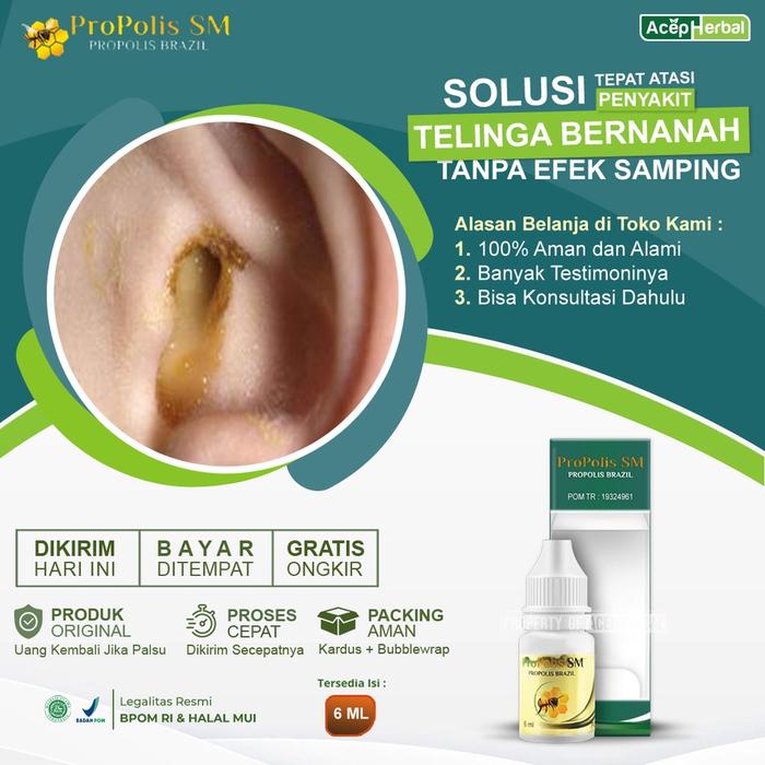 OBAT TELINGA BERNANAH TELINGA CUREK BERAIR CONGEK BASAH KERING TULI BUDEK GENDANG TELINGA BOCOR TELI