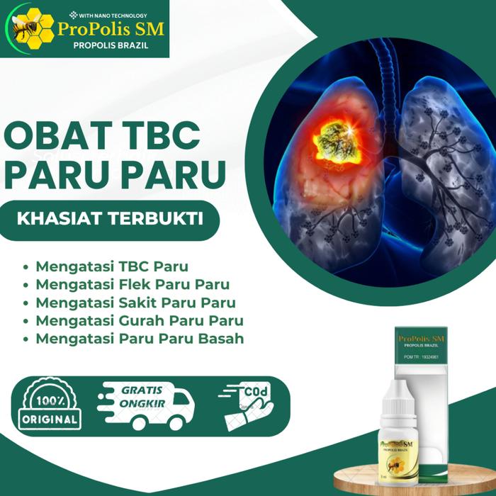OBAT TBC PARU, FLEK PARU PARU, SAKIT PARU PARU, LENDIR PARU PARU, GURAH PARU PARU DENGAN PROPOLIS SM