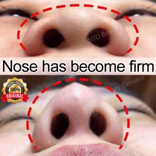 Esensi Pemancung Hidung Hasil Alami Permanen Pembentuk Hidung dan Tulang Hidung Indah Nose lift up e