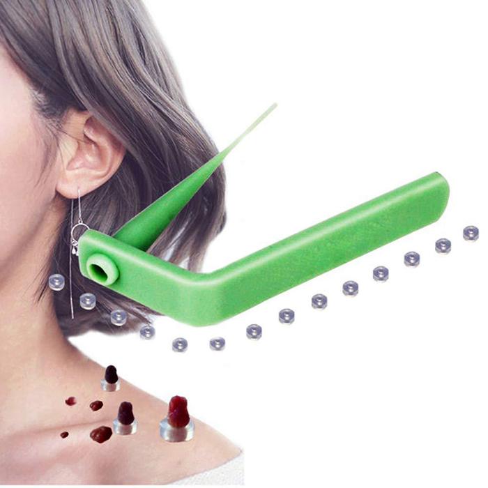 Medical Skin Tag Kill Skin Mole Wart Remover Micro Band Skin Tag