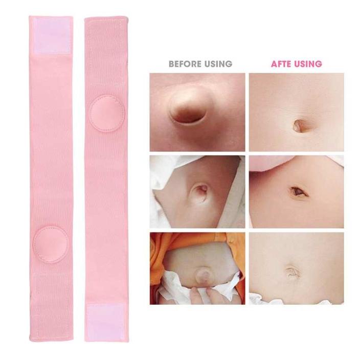 2pcs Umbilical Hernia Therapy Treatment Belt Breathable Bag Elastic