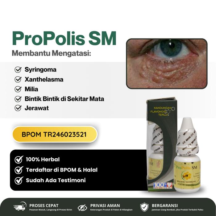PROPOLIS SM - OBAT PENGHILANG SYRINGOMA, MILIA DI BAWAH MATA, BINTIK PUTIH MILIA DI BAWAH MATA, BERU