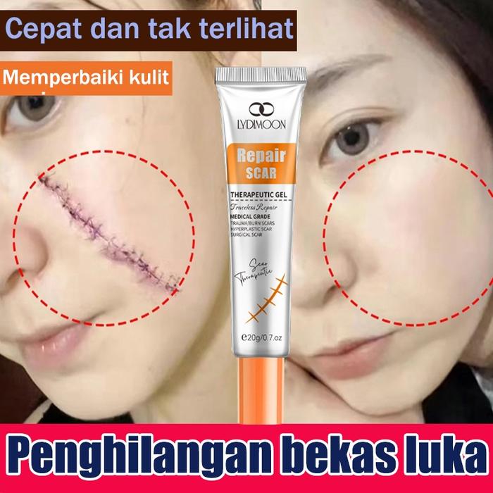 Penghilang Bekas Luka Bekas Luka Penghilang Cream Penghilang Bekas Luka Cream Penghilang Bekas Luka 