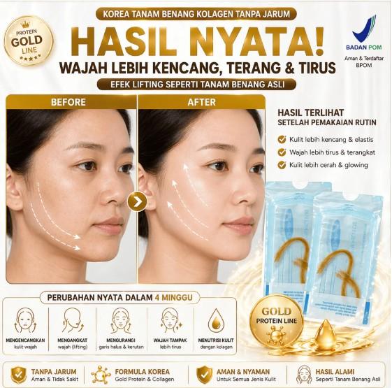 AM ~ Benang Radar Tanpa Jarum Benang Wajah Kolagen Intisari