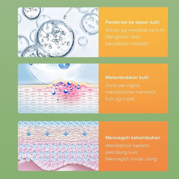 Salap Gatal Kulit Yang Ampuh Salep China Untuk Gatal Gatal Salep Eksim Salep Gatel Anti Gatal Herbal
