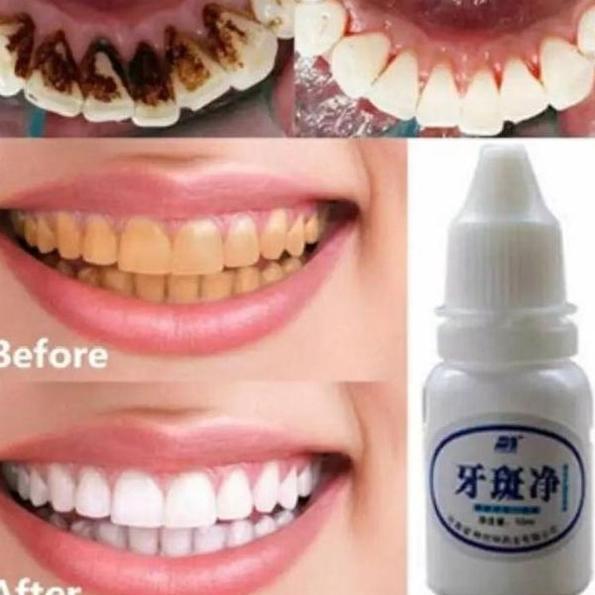 Original Pemutih Gigi Efero Teeth Whitening Essence Penghilang Karang