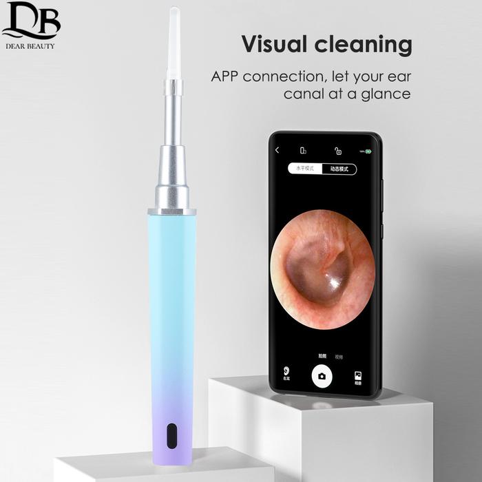 Otoskop Visual Nirkabel Alat Pembersih Telinga Korek Telinga Visual