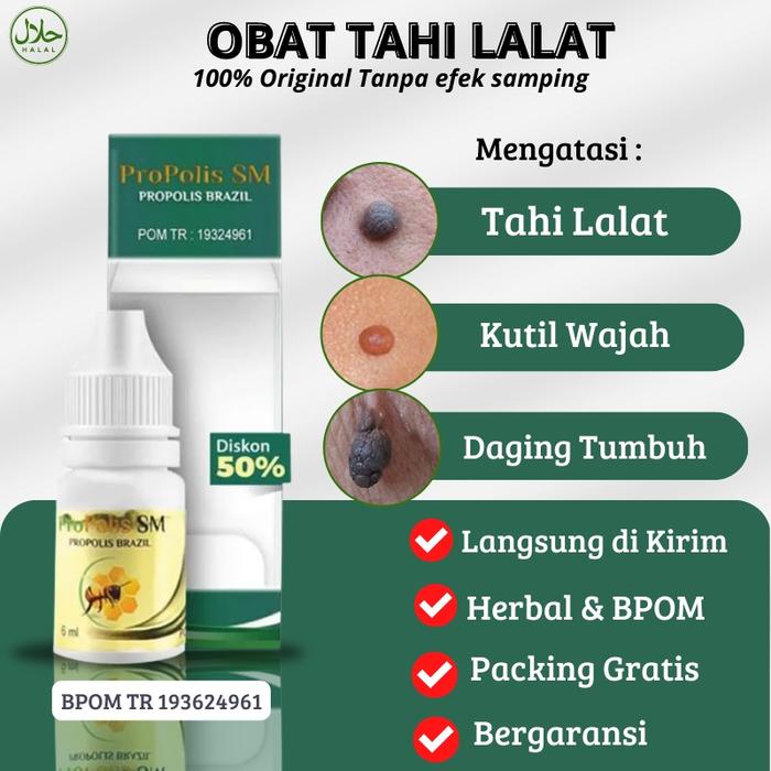 PROPOLIS SM - PENGHILANG TAHI LALAT, OBAT PENGHILANG TAHI LALAT DI WAJAH, OBAT TAHI LALAT DI WAJAH,