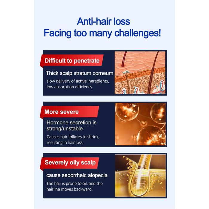 LESCOLTON helm Laser penumbuh rambut, topi Laser perawatan rambut