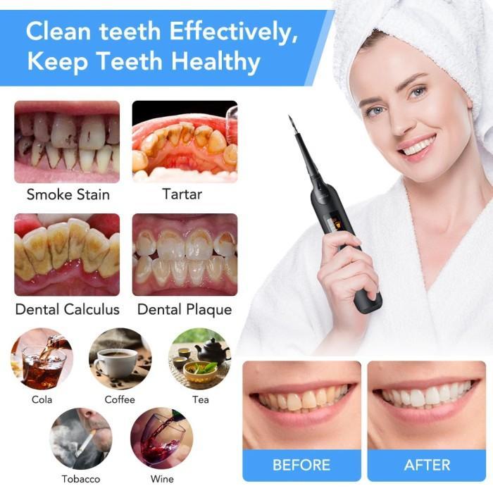 Barang Terlaris Alat Pembersih Karang Gigi Youpin Dental Calculus