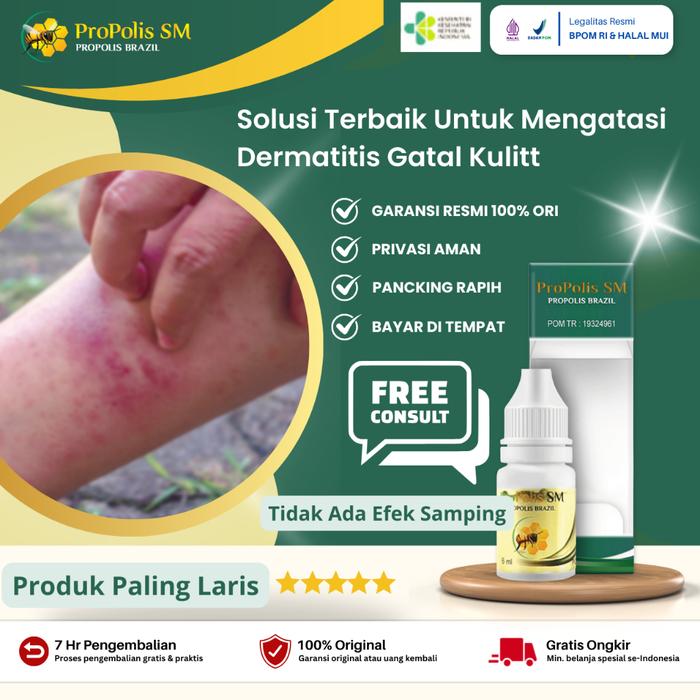 PROPOLIS SM - OBAT DERMATITIS SEBOROIK, OBAT DERMATITIS PERIONAL, OBAT DERMATITIS NUMULARIS, OBAT DE